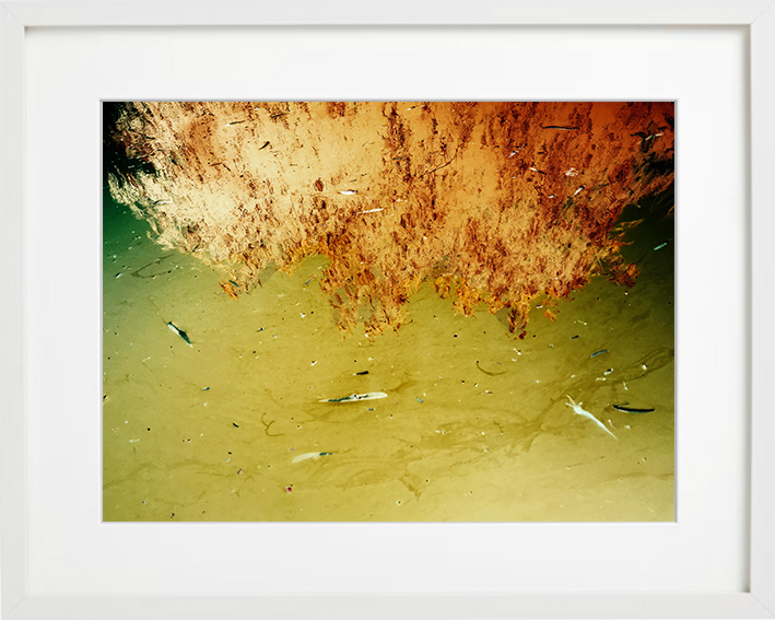 apnea